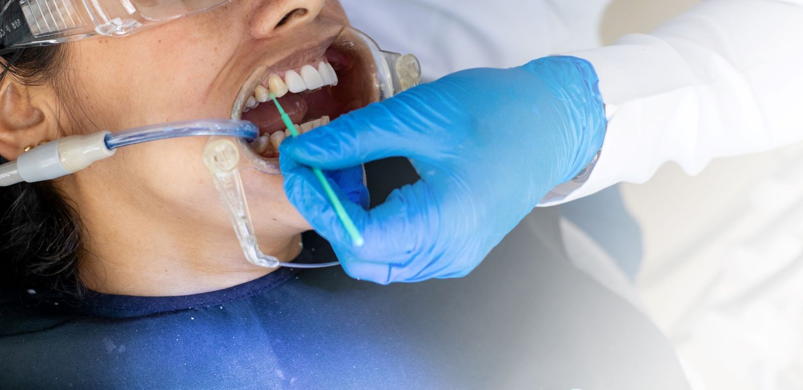Braces and Aligners
